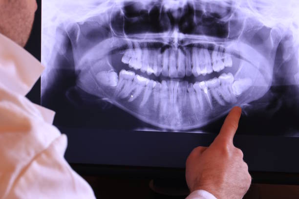 Best Emergency Treatment for Toothache in Dilkon, AZ